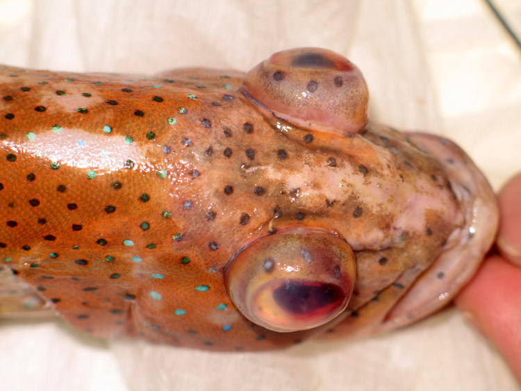 Exophthalmia
